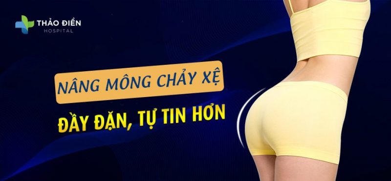 Nâng mông chảy xệ