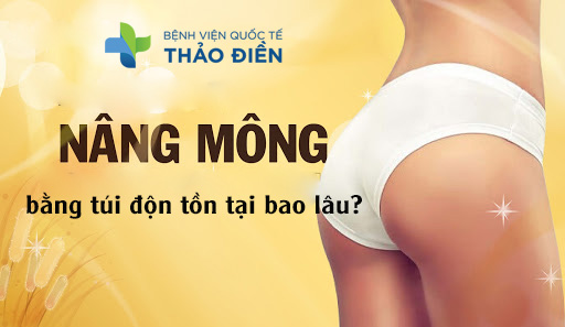 nâng mông bằng túi độn tồn tại bao lâu